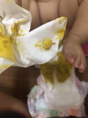 怎么让宝宝拉粑粑