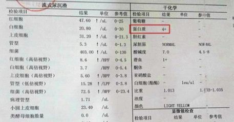 24小时尿蛋白2.43g高多少