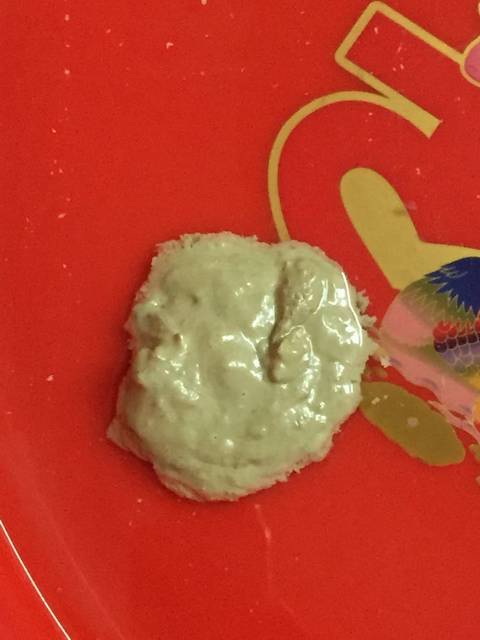 屎是白色的怎么回事