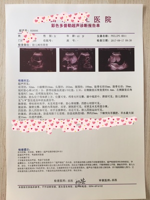 新生儿血小板偏低