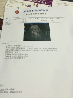 白带褐色是怀孕吗