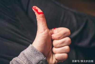 梦见自己手指流血