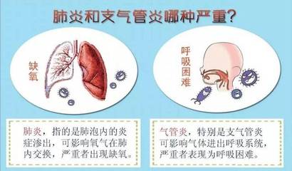 支气管发炎咳嗽