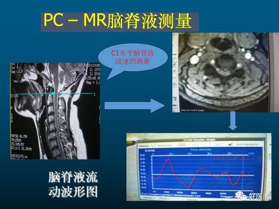 变频器op2是什么故障