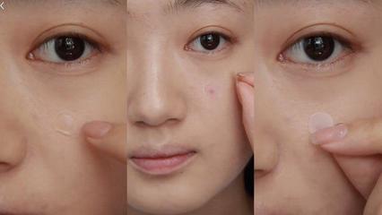 痘痘贴要多久