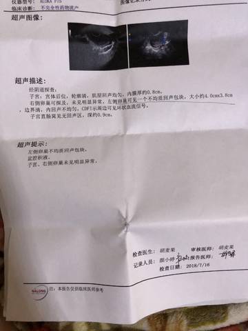 卵巢包块是怎么回事