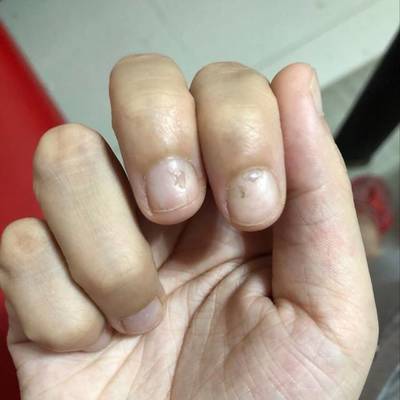 不知道怀孕做了指甲