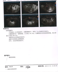 没排卵内膜多少正常