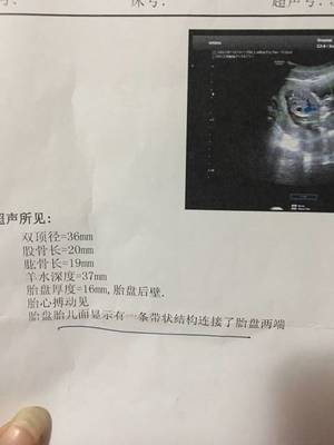 四个月双顶径多少正常