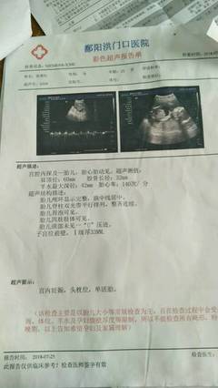 六个月胎儿双顶径标准