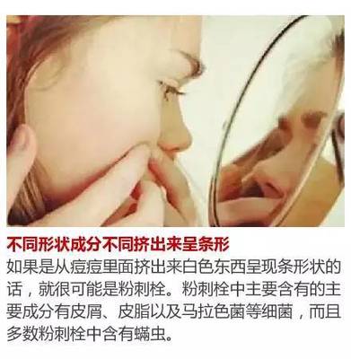 痘痘白白的要不要挤掉