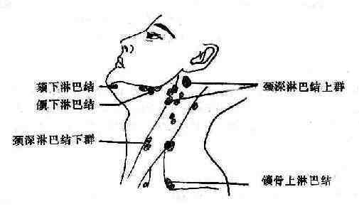 一岁宝宝耳后淋巴结肿大怎么办