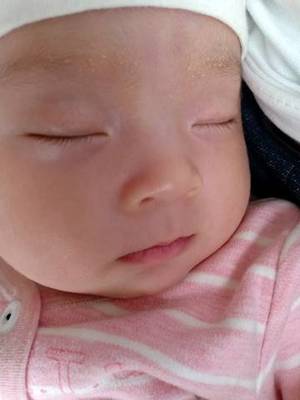 两岁宝宝眼皮肿怎么回事