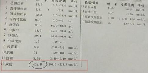 成年人尿酸正常是多少