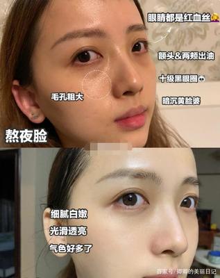 红血丝皮肤用什么面膜