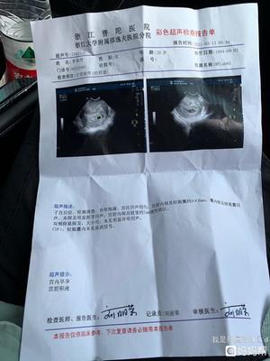 怀孕宫内有积液是怎么回事