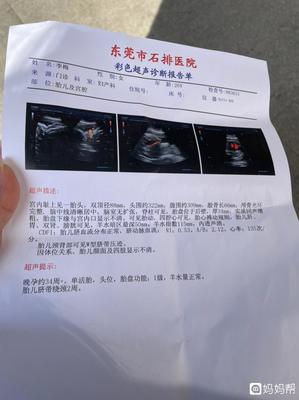 34周的胎儿