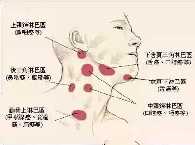 脖子两侧淋巴疼是怎么回事