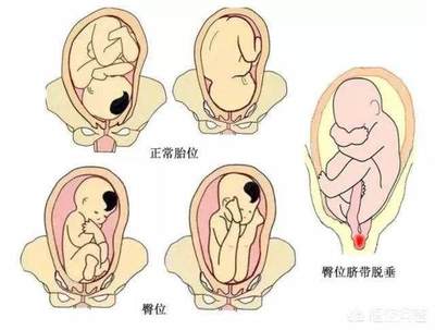宝宝多少周入盆属正常