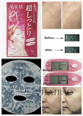 出油痘痘痘印面膜