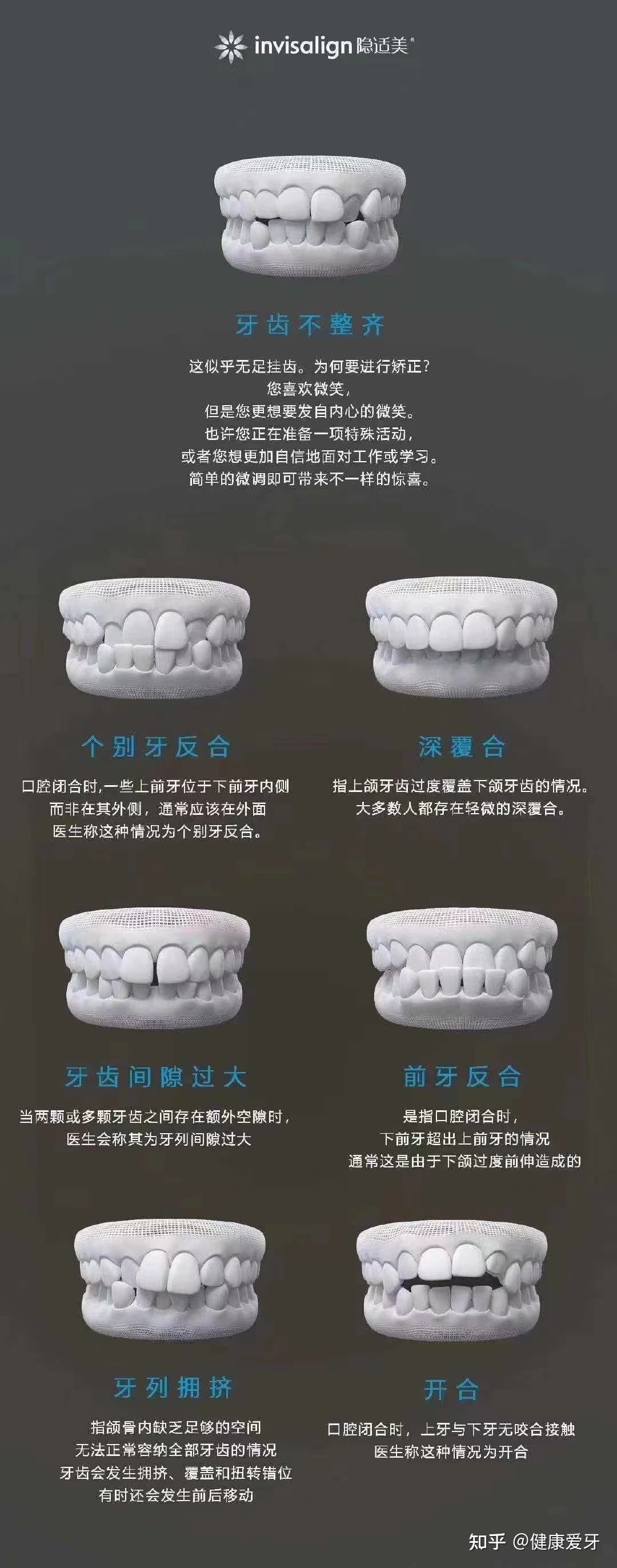 牙齿矫正和正畸的区别