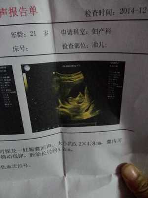 怀孕三个月胎儿位置图