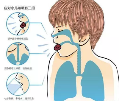 支气管发炎咳嗽