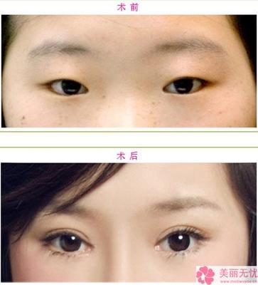正八字眉