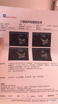 卵泡多大容易怀孕