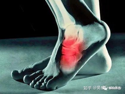 脚外侧疼是怎么回事