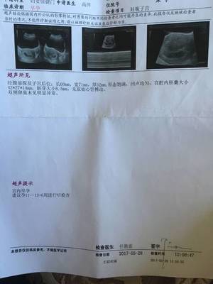 怀孕抽血需要空腹么