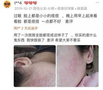 脸上的痘痘有什么分类