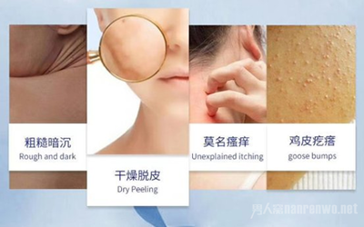 痘痘男護膚哪個好