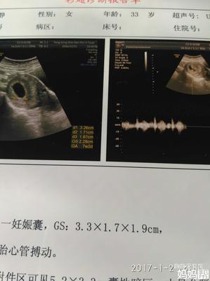 孕囊33*23怀孕多少天