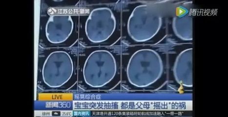 脑子有积液是怎么回事