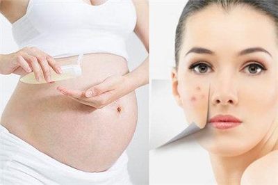 孕妇用护肤品对胎儿有什么影响
