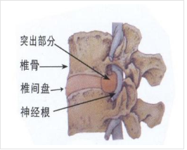 双下肢神经受损怎么治疗