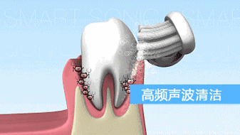 牙齿爆裂治疗方法