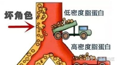 总胆固醇偏高怎么治疗