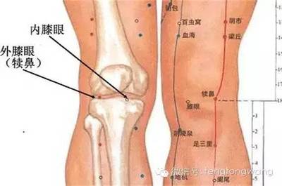 膝盖关节骨刺怎么治疗