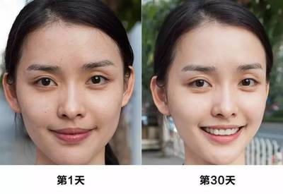 敏感肌脸上总是小痘痘