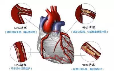 心机缺血是怎么回事