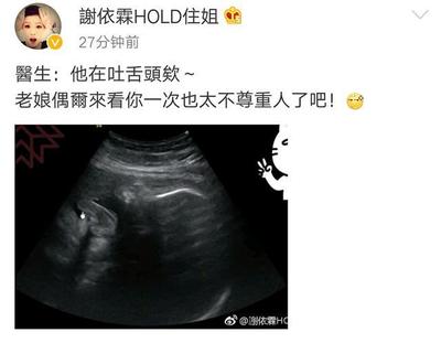 怀孕几个月知道男女