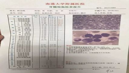 正常人血小板是多少万