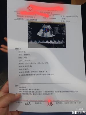 胎儿发育小