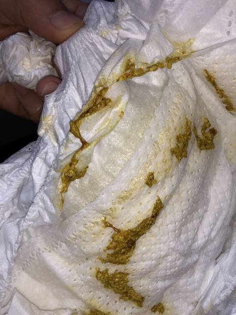 宝宝拉的粑粑黏糊糊的