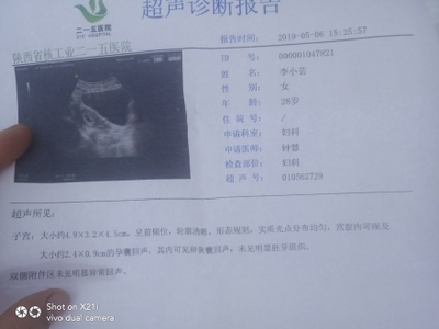 怀孕几周能看到孕囊
