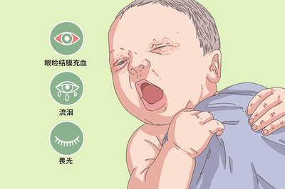 新生儿结膜炎的症状
