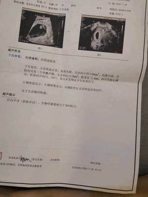 怀孕一个月会拉肚子吗