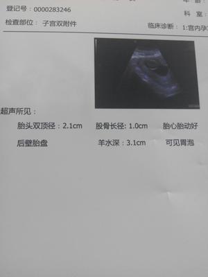 怀孕三个月怎么看男女